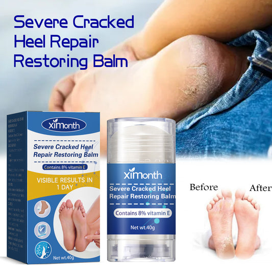 Moisturizing Heel Repair Cream Anti-heel Crack Peeling Dry