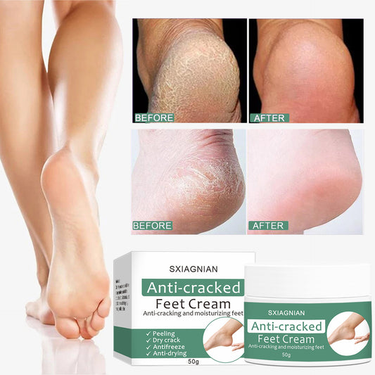 Moisturizing Foot Anti-crack Heel Dandruff Peeling Cream